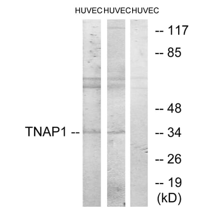 Western Blot - Anti-TNAP1 Antibody (C11006) - Antibodies.com