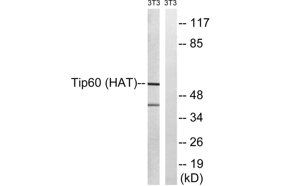 Western Blot - Anti-Tip60 Antibody (B8434) - Antibodies.com