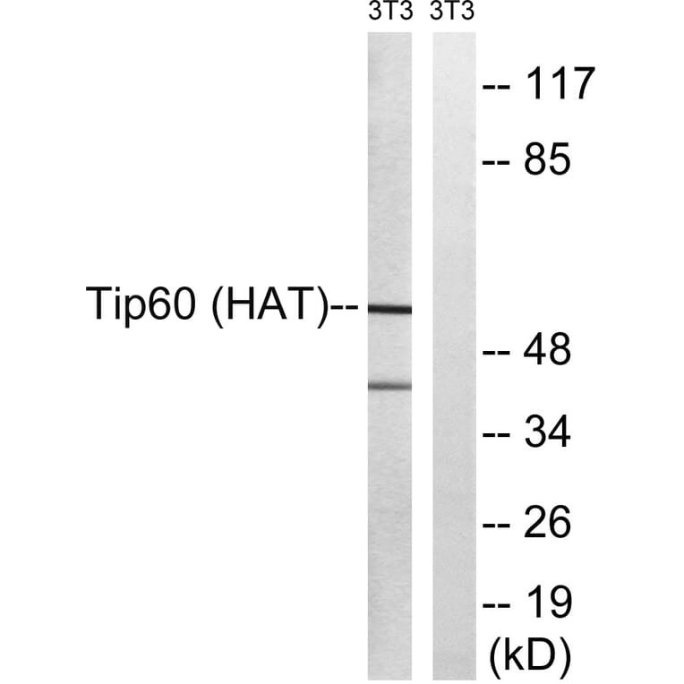 Western Blot - Anti-Tip60 Antibody (B8434) - Antibodies.com