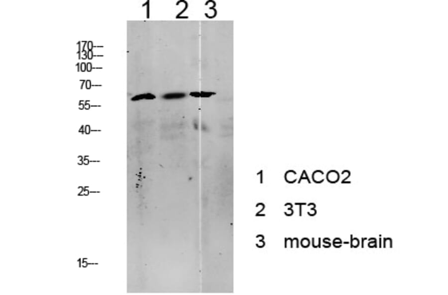 Western Blot - Anti-Tip60 Antibody (B8434) - Antibodies.com
