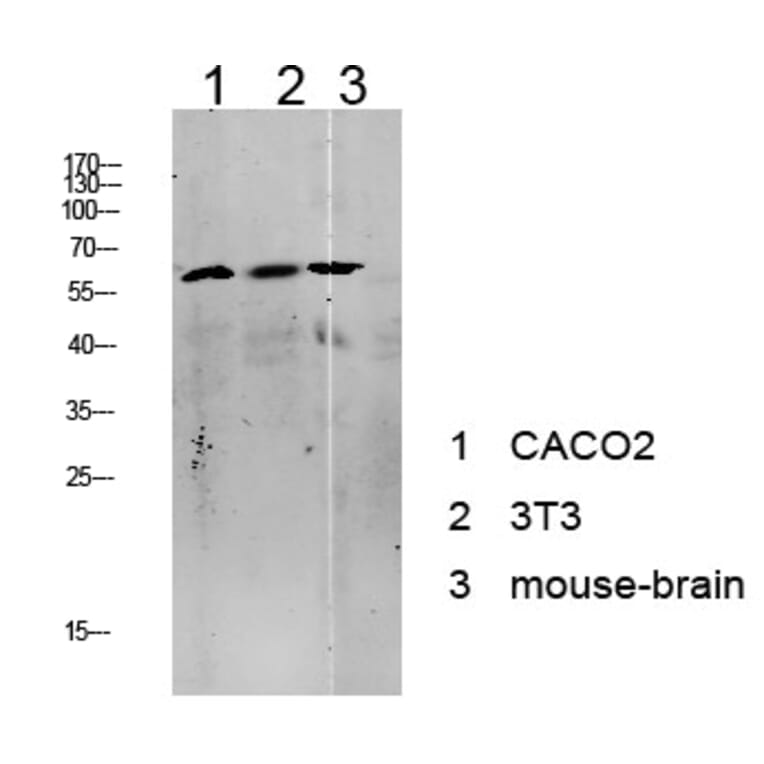 Western Blot - Anti-Tip60 Antibody (B8434) - Antibodies.com