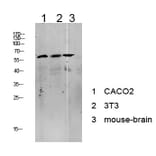 Western Blot - Anti-Tip60 Antibody (B8434) - Antibodies.com