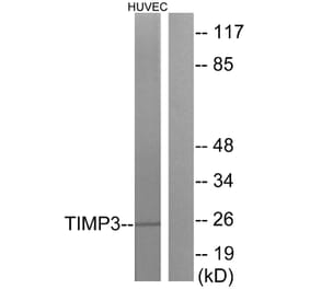 Western Blot - Anti-TIMP3 Antibody (C0349) - Antibodies.com