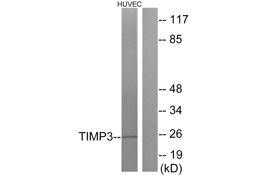 Western Blot - Anti-TIMP3 Antibody (C0349) - Antibodies.com
