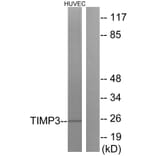 Western Blot - Anti-TIMP3 Antibody (C0349) - Antibodies.com