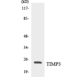 Western Blot - Anti-TIMP3 Antibody (R12-3625) - Antibodies.com