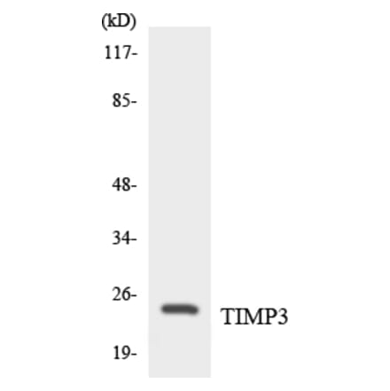 Western Blot - Anti-TIMP3 Antibody (R12-3625) - Antibodies.com