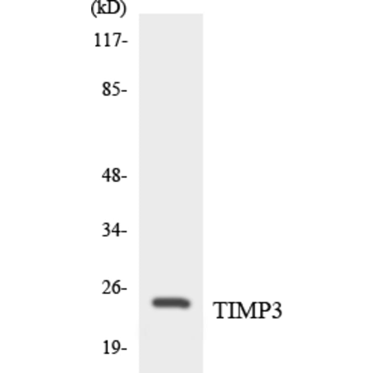 Western Blot - Anti-TIMP3 Antibody (R12-3625) - Antibodies.com