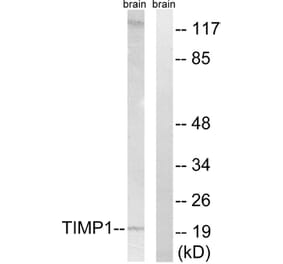 Western Blot - Anti-TIMP1 Antibody (C0347) - Antibodies.com