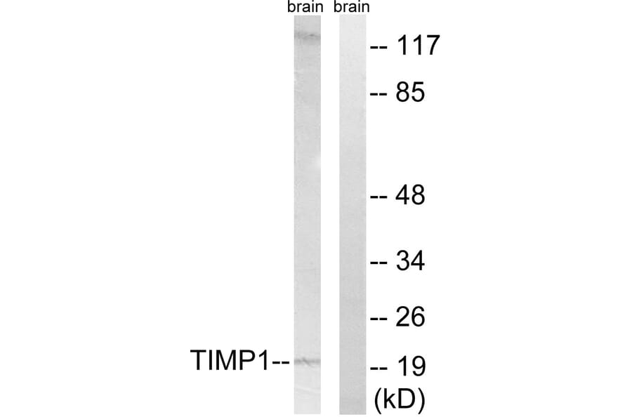 Western Blot - Anti-TIMP1 Antibody (C0347) - Antibodies.com