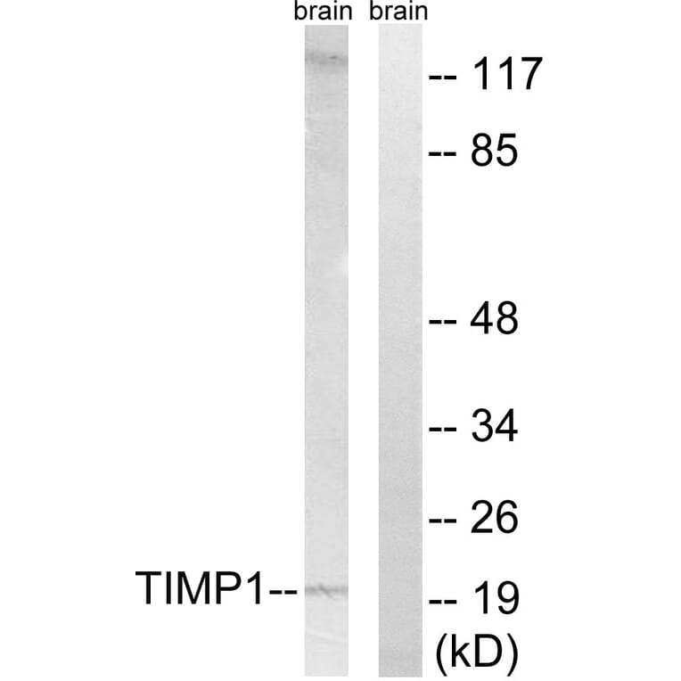 Western Blot - Anti-TIMP1 Antibody (C0347) - Antibodies.com