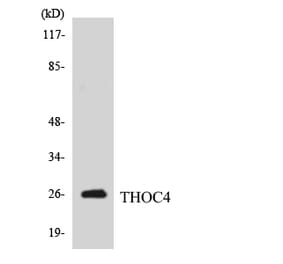 Western Blot - Anti-THOC4 Antibody (R12-3622) - Antibodies.com