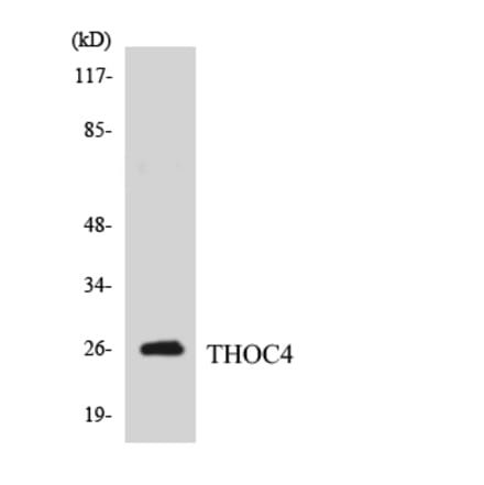Western Blot - Anti-THOC4 Antibody (R12-3622) - Antibodies.com