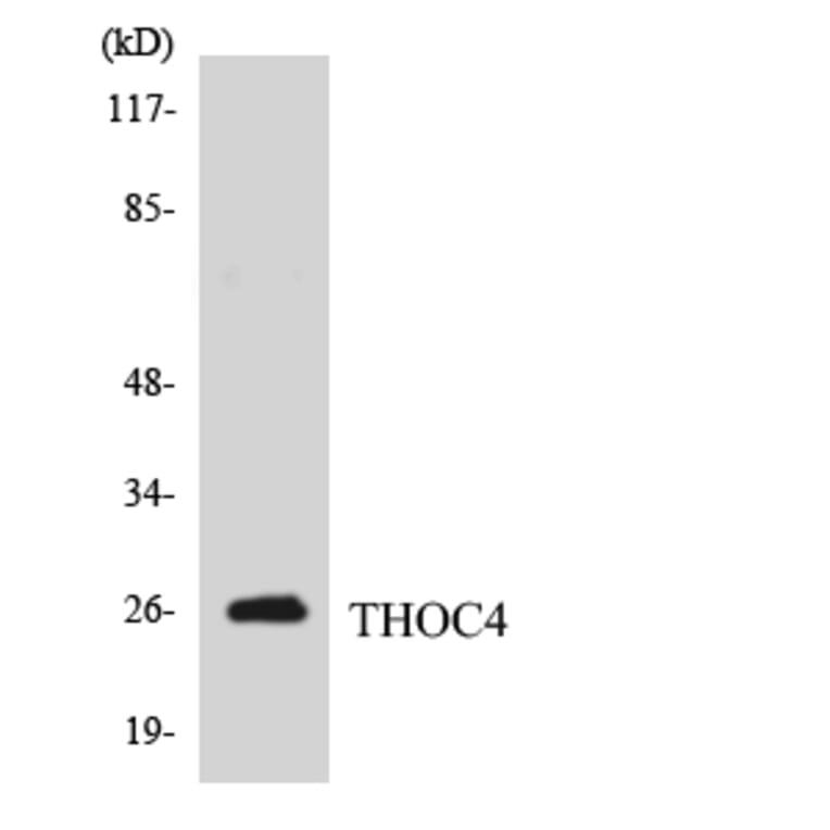 Western Blot - Anti-THOC4 Antibody (R12-3622) - Antibodies.com