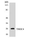 Western Blot - Anti-THOC4 Antibody (R12-3622) - Antibodies.com