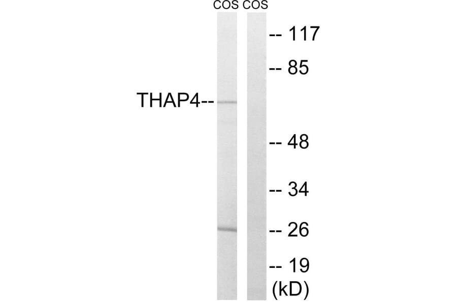 Western Blot - Anti-THAP4 Antibody (C19099) - Antibodies.com