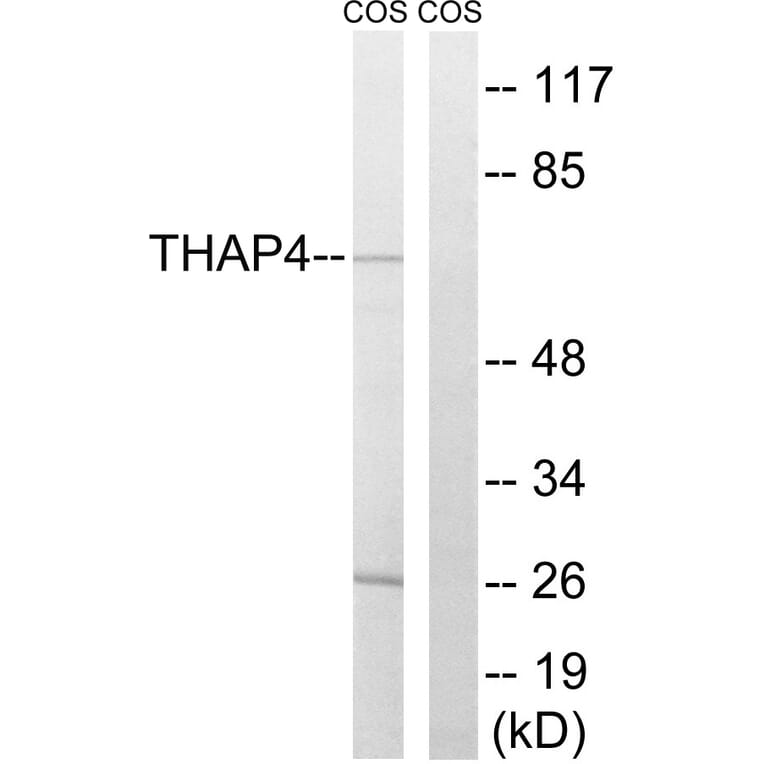 Western Blot - Anti-THAP4 Antibody (C19099) - Antibodies.com