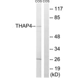 Western Blot - Anti-THAP4 Antibody (C19099) - Antibodies.com