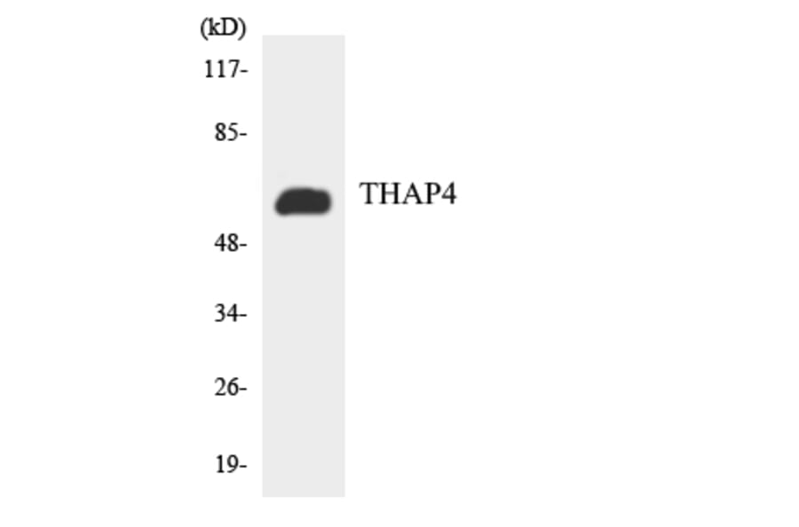 Western Blot - Anti-THAP4 Antibody (R12-3620) - Antibodies.com