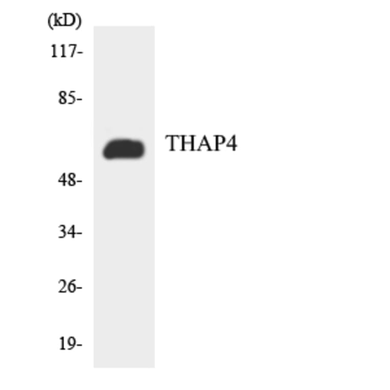 Western Blot - Anti-THAP4 Antibody (R12-3620) - Antibodies.com