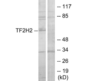 Western Blot - Anti-TF2H2 Antibody (C11010) - Antibodies.com