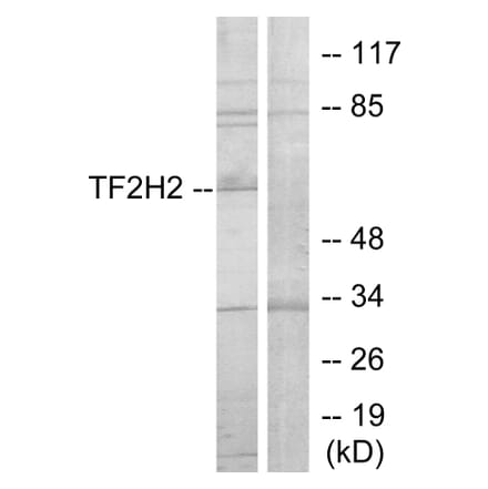 Western Blot - Anti-TF2H2 Antibody (C11010) - Antibodies.com