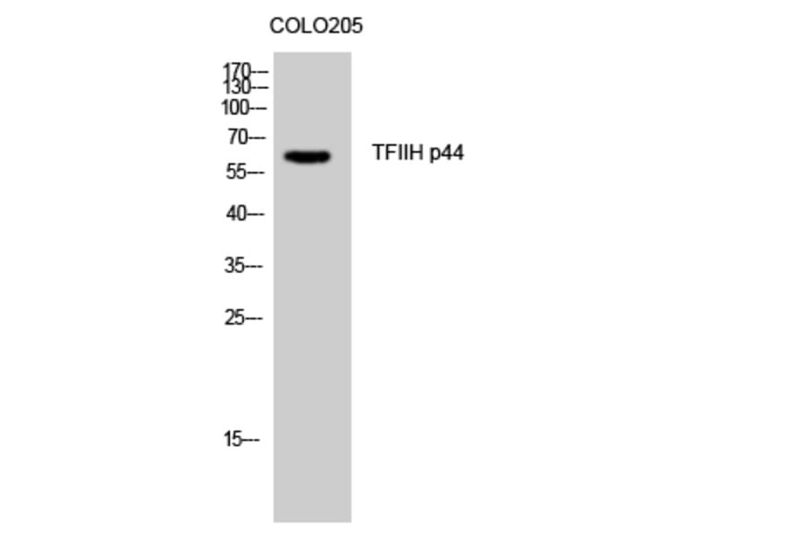 Western Blot - Anti-TF2H2 Antibody (C11010) - Antibodies.com