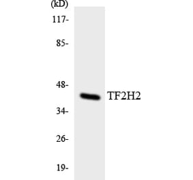 Western Blot - Anti-TF2H2 Antibody (R12-3614) - Antibodies.com