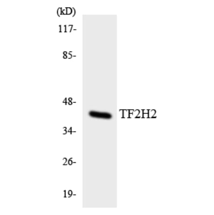 Western Blot - Anti-TF2H2 Antibody (R12-3614) - Antibodies.com