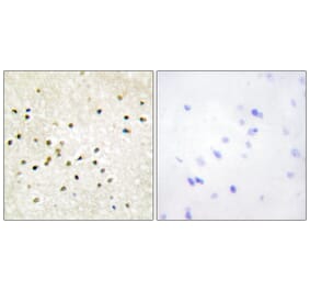 Immunohistochemistry - Anti-TF2H1 Antibody (C10539) - Antibodies.com