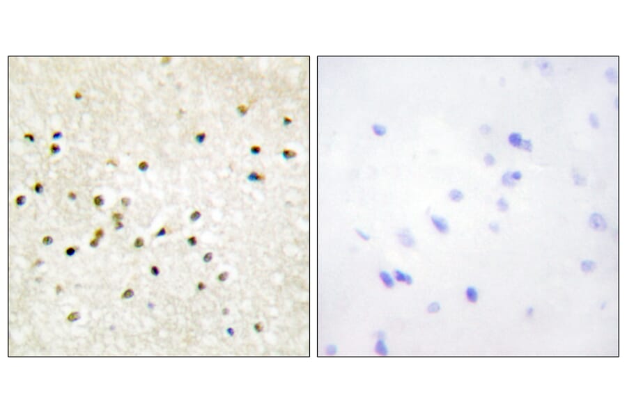 Immunohistochemistry - Anti-TF2H1 Antibody (C10539) - Antibodies.com