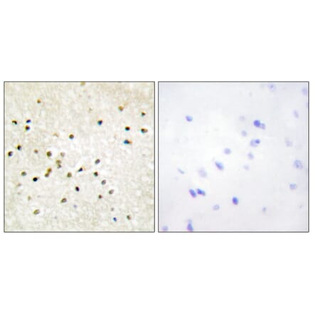 Immunohistochemistry - Anti-TF2H1 Antibody (C10539) - Antibodies.com