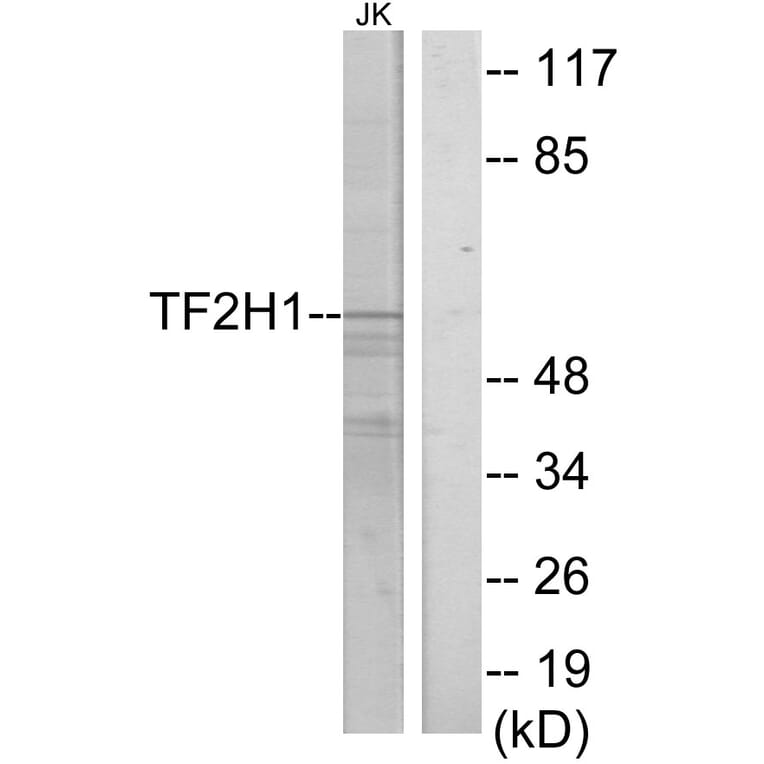 Western Blot - Anti-TF2H1 Antibody (C10539) - Antibodies.com