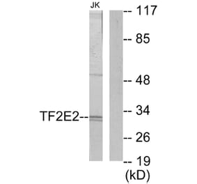 Western Blot - Anti-TF2E2 Antibody (C10506) - Antibodies.com