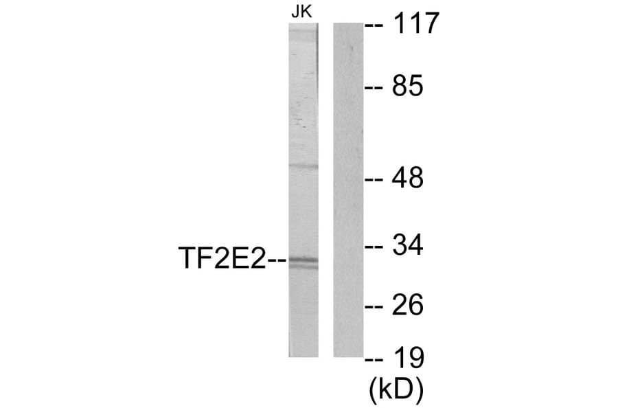 Western Blot - Anti-TF2E2 Antibody (C10506) - Antibodies.com