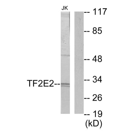Western Blot - Anti-TF2E2 Antibody (C10506) - Antibodies.com