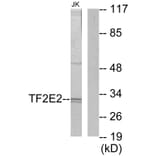 Western Blot - Anti-TF2E2 Antibody (C10506) - Antibodies.com