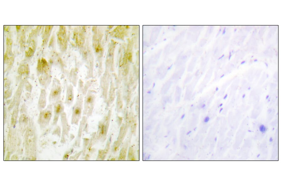 Immunohistochemistry - Anti-TF2E2 Antibody (C10506) - Antibodies.com
