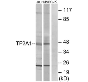 Western Blot - Anti-TF2A1 Antibody (C10702) - Antibodies.com