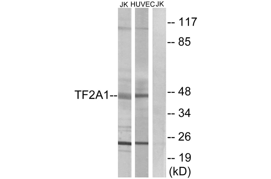 Western Blot - Anti-TF2A1 Antibody (C10702) - Antibodies.com
