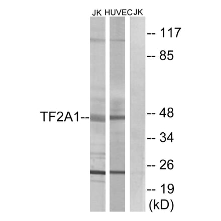 Western Blot - Anti-TF2A1 Antibody (C10702) - Antibodies.com