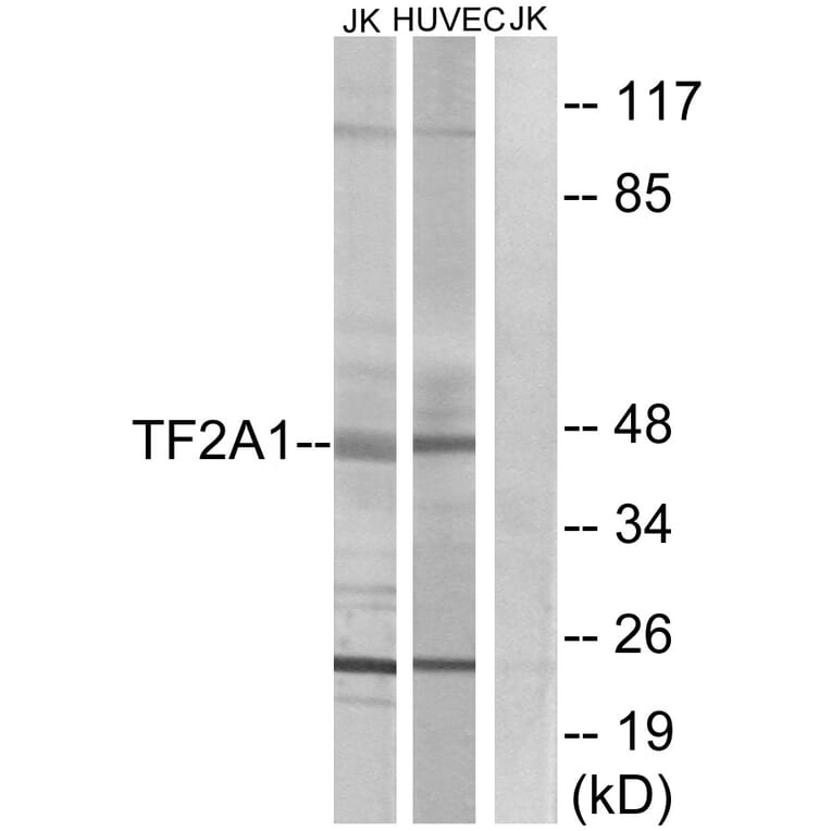 Western Blot - Anti-TF2A1 Antibody (C10702) - Antibodies.com