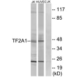 Western Blot - Anti-TF2A1 Antibody (C10702) - Antibodies.com