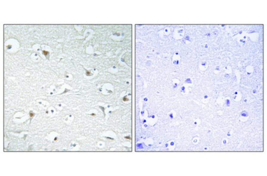 Immunohistochemistry - Anti-TF2A1 Antibody (C10702) - Antibodies.com