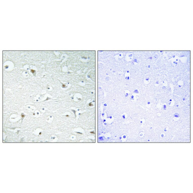 Immunohistochemistry - Anti-TF2A1 Antibody (C10702) - Antibodies.com