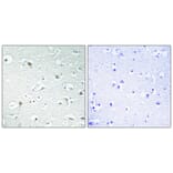 Immunohistochemistry - Anti-TF2A1 Antibody (C10702) - Antibodies.com