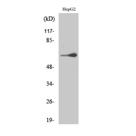 Western Blot - Anti-TESK2 Antibody (C21223) - Antibodies.com