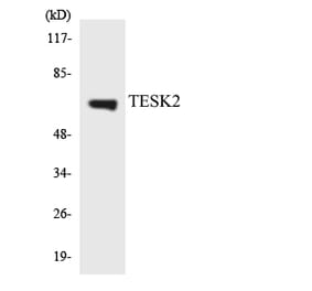 Western Blot - Anti-TESK2 Antibody (R12-3612) - Antibodies.com