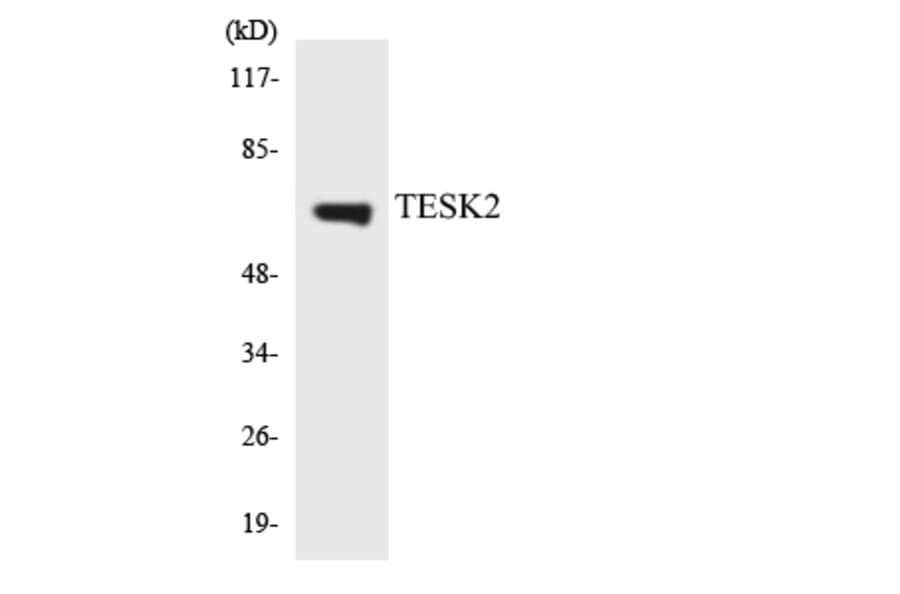 Western Blot - Anti-TESK2 Antibody (R12-3612) - Antibodies.com