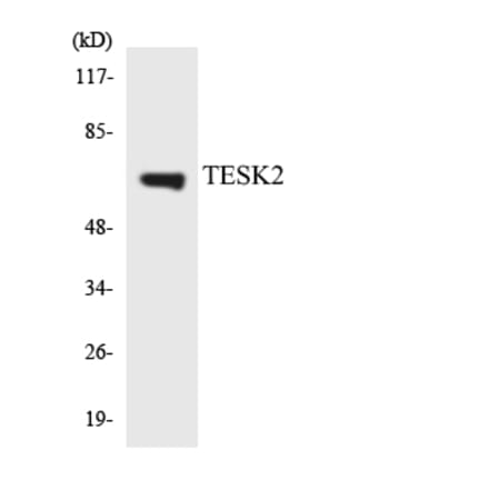 Western Blot - Anti-TESK2 Antibody (R12-3612) - Antibodies.com